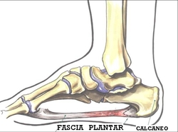 traumatologia pie lesiones arco plantar interno fascitis plantar